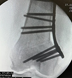 Contusion y Hematoma.JPG (973898 bytes)